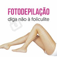 A Fotodepilação é indicada para tratamentos de foliculite já que não causa tanta dor e nem favorece a entrada de bactérias. #fotodepilação #foliculite #depilacao #depiladora #biomedica