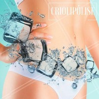 A criolipólise é feita com a ajuda de um aparelho específico cujos aplicadores acoplam-se perfeitamente às diferentes áreas do corpo. A ponteira do aparelho realiza um poderoso vácuo que promove a sucção da pele e da porção de gordura localizada. Ao mesmo tempo, o resfriamento intenso e controlado da gordura destrói as células do tecido adiposo. O resfriamento controlado age danificando seletivamente as células de gordura, que são mais sensíveis ao frio, sem causar qualquer dano aos nervos, músculos e outras estruturas próximas.
