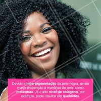 A pele negra merece atenção especial para que não sofra com problemas como manchas no rosto, excesso de oleosidade e foliculite. Por isso, o ideal seria procurar um profissional para que você possa tratar essas efemeridades, atualmente existem inúmeras opções de tratamentos, não deixe de fazer o seu! #ahazou #estética #estéticacomamor #bemestar #saúde #beauty #beleza