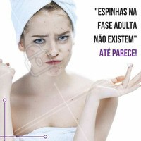 Mesmo depois da adolescência, há que ainda sofra com as espinhas, a acne na fase adulta é bem mais comum nas mulheres, algumas das causas podem ser, predisposição génetica, alimentação, cosmésticos, medicamentos, entre outros. Procure um profissional para eliminar esse incomodo! #ahazou #estética #estéticacomamor #beauty #beleza #saúde #bemestar
