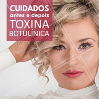 - Evitar massagens, limpeza de pele ou outros movimentos de pressão no rosto durante 3 dias.
- A área tratada não deve ser exposta a frio ou calor intenso, assim compressas quentes ou geladas são contra indicadas.
- Evitar esforços físicos por um período de 24 horas.
- Não usar cosméticos e produtos dermatológicos um dia antes e um dia após à aplicação. O uso de maquiagem pode ser feito na manha seguinte a aplicação.
#ahazou #beauty #instabeauty #estéticacomamor #estéticaesaúde #bemestar #saúde #botox #toxinabotulinica