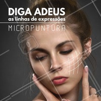 Micropuntura é um dos tratamentos mais indicado para diminuir as dito cujas linhas de expressão, o tratamento é natural e não é agressivo, pois faz com que a pele produza colágeno, amenizando as marcas e rugas visivelmente e assim deixando a pele mais clara. #ahazou #estéticacomamor #estética #estéticaesaúde #saúde #saúdebemestar #bemestar #beauty