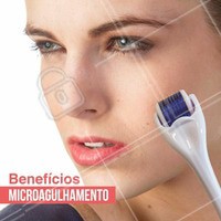 - Disfarça manchas e clareia a pele.
- Lifting e rejuvenescimento da pele.
- Ajuda a disfarçar cicatrizes causadas pela acne ou por feridas.
- Ajuda a disfarçar rugas e as linhas de expressão, especialmente aquelas em redor dos olhos ou logo acima do lábio superior. #ahazou #estéticacomamor #estética #estéticaesaúde #saúde #beleza #microagulhamento #dermaroller #tratamentofacial