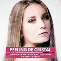 Peeling de Cristal, resultados expressivos a partir da terceira sessão. Marque seu horário #peelingdecristal #esteticasaudavel #rejuvenescimentofacial