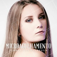 O rolo com as agulhas, utilizado para realizar o microagulhamento, não pode ser auto-clavado e qualquer outro procedimento de assepsia não remove todas as impurezas. O mecanismo de ação se dá de forma que quando a agulha é penetrada na pele, causa uma lesão controlada, e como toda lesão, existe a fabricação de “ingredientes” para a formação de um novo tecido. Se interessou? Procure sua biomédica esteta! #ahazou #biomedicina #saude #bemestar #beauty #beleza #microagulhamento