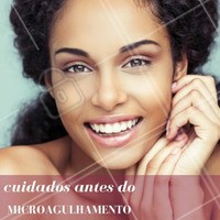 O procedimento padrão para fazer seu microagulhamento, é interromper o uso de qualquer ácido na pele entre 72 e 48 horas antes do tratamento, mas as recomendações dependem do seu tipo de pele, então não deixe de consultar um profissional. #Microagulhamento #Cuidados #Procedimento