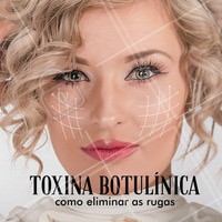 A toxina botulínica é uma das substâncias mais importantes no campo do rejuvenescimento facial. Parecida com o lifting cirúrgico, esta substância é a forma mais popular de redução de rugas faciais.As rugas fazem você parecer cansado ou até irritado quando não está. Uma das soluções mais rápidas e mais seguras para remover as rugas é a injeção de toxina botulínica.
#ahazou #saúdeebemestar #beleza #pele #botox #peleperfeita