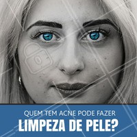 Ao contrário do que a maioria acredita, para quem possui pústulas e inflamação severa a limpeza de pele não é o procedimento mais indicado. Isso porque pode deixar o paciente com cicatrizes, além de poder agravar a inflamação assim como o quadro da acne. Ainda assim, o ideal é procurar o auxilia de um profissional. Uma avaliação é sempre de extrema importância em cada caso. #acne #estética #limpezadepele