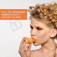 Muitas vezes o sucesso do tratamento está simplesmente aliado á mudança de hábitos alimentares, quando falamos em uma alimentação equilibrada, principalmente para tratamento da acne, falamos em uma dieta rica em nutrientes e pobre em gorduras. Deve ser rica em peixes, como sardinha ou salmão, porque são fontes de gordura do tipo ômega 3, que é anti-inflamatória, inibindo e controlando a inflamação dos folículos sebáceos que formam a espinha.
#beleza #beauty #ahazou #acne #cuidadoscompele #esteticafacial #tratamentofacial