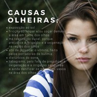 As olheiras são alterações cutâneas na região dos olhos causadas por intenso estresse e carência de sono com boa qualidade ou péssimos hábitos. Agende seu horário para tratá-las. #olheiras #olhos #beleza #ahazou #esteticafacial #tratamentofacial
