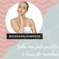 O microagulhamente tem como uma de suas funções a indução de um processo inflamatório na área onde é realizado, que estimula as células responsáveis pela produção de colágeno, deixando a pele mais firme e aparência jovem. Além disso, através das pequenas perfurações feitas pelas agulhas, ocorre uma redução da pigmentação de manchas. #microagulhamento #benefícios #estéticafacial