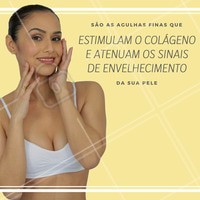 Você já conhece o #microagulhamento? Fique com a pele linda, agende seu horário. #estéticafacial #horário #manchas #rejuvenescimento