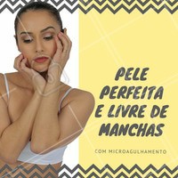 O microagulhamente tem como uma de suas funções a indução de um processo inflamatório na área onde é realizado, que estimula as células responsáveis pela produção de colágeno, deixando a pele mais firme e aparência jovem. Além disso, através das pequenas perfurações feitas pelas agulhas, ocorre uma redução da pigmentação de manchas. #microagulhamento #benefícios #estéticafacial