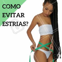 As estrias se formam quando há destruição de fibras elásticas colágenas na pele. Portanto para que isso não aconteça é importante manter o corpo bem hidratado sempre, beber bastante água diariamente, praticar exercícios físicos regularmente e alimentar-se bem. #estrias #prevenção #estéticacorporal