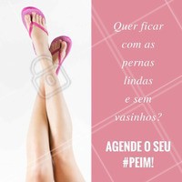 O Procedimento Estético Injetável para Microvasos, conhecido popularmente como “aplicação de vasinhos”, é a solução para você se livrar dos vasinhos. Marque o melhor horário para você e tenha uma experiência incrível com este procedimento! #PEIM #Microvasos #Beleza #TratamentoInjetável #Ahazou
