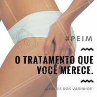 A técnica PEIM é muito utilizada para microvasos de 1 a 2 mm, cujos pacientes não tenham comprometimento circulatório. O procedimento é realizado com uma agulha fina que injeta uma substância no interior dos vasos que colaborarão e desta forma, melhoram o aspecto inestético. #PEIM #Microvasos #Beleza #TratamentoInjetável #Ahazou