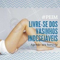 O Procedimento Estético Injetável para Microvasos (PEIM) faz com que com que os "vasinhos" desapareçam completamente. Agende o seu horário para um resultado incrível de pernas mais lindas! #PEIM #Microvasos #Beleza #TratamentoInjetável #Ahazou