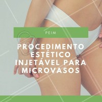 O PEIM, popularmente conhecido como secagem de vasinhos, é um procedimento destinado a tratamento estético de microvasos e telangiectasias de membros inferiores. Agende já o seu horário e trate os seus vasinhos com uma profissional! #PEIM #Microvasos #Beleza #TratamentoInjetável #Ahazou