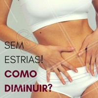 A dica principal é: se está fazendo regime ou está grávida, capriche na hidratação da pele! Existem cremes específicos para o tratamento das estrias, não deixe de usa-los, se for o caso, também há tratamentos estéticos, como o laser, o laser provoca uma reação inflamatória no local e regenera toda a região afetada pelas marquinhas. Melhora quase totalmente as estrias vermelhas e acaba com metade das brancas. #ahazou #estéticacomamor #beauty