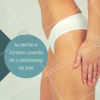 Como surgem as estrias, você sabia?
#ahazou #ahz #beauty #beleza
