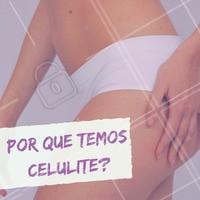Vários são os fatores envolvidos na gênese desta patologia estética. Os principais são: herança genética, a principal causa, já que a programação genética para celulite é o fator preponderante que determina o quadro; hormonal, quando hormônios incluindo anticoncepcionais podem iniciar ou agravar o quadro; alimentação, no abuso de alimentos gordurosos e pobres em fibras, que pioram a celulite; e o sedentarismo. #ahazou #beleza #beauty