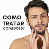 Evite a automedicação e espremer os comedões! É muito útil a limpeza de pele, com esteticista experiente, o uso de esfoliantes (sabonetes, cremes, loções), peeling de diamante ou cristal, peelings químicos superficiais, à base de ácido retinoico, ácido glicólico, salicílico e alguns medicamentos de uso local, como ácido retinoico, adapaleno, peróxido de benzoíla, e outros.
#ahazou #estetica #comedões #saúde #bemestar #estéticaparahomens #homens #esteticamasculina #masculino