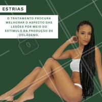 Não existe tratamento que elimine completamente as estrias! Por isso, não saia comprando produtos que prometem remover as estrias antes de uma avaliação profissional. Laser, peeling, cremes com ácido e radiofrequência fracionada podem ajudar a melhorar o aspecto. #beleza #pele #estrias #estéticacorporal