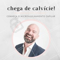Você está sofrendo com a queda de cabelos? Conheça o microagulhamento capilar, tratamento usado para combater esse problema tão desconfortável! Agende já o seu horário. #microagulhamentocapilar #cabelo #estetica #ahazou #careca #calvice
