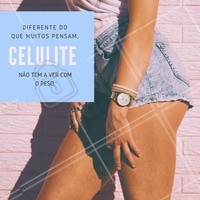 Infelizmente nossa cultura nos deixa com a ideia errônea, na qual associamos a celulite apenas aos quilinhos a mais por pensarmos que é o peso extra quem traz essa condição. Apesar da flacidez e gordura ajudarem a aumentar a celulite, não é o único fator! Pessoas magras também podem ter esse aspecto na pele por motivos genéticos ou hormonais por exemplo. #celulite #ahazou #gordura #estéticacorporal #beleza