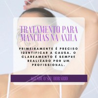 A remoção delas é feita com cremes clareadores, peelings ou até mesmo com laser.
Agende o seu horário e saiba qual é o ideal para você!
#clareamentodasaxilas #axilas #bemestar #ahazou #clareamento