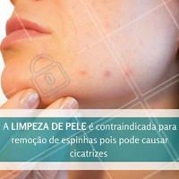 A limpeza de pele é indicada, principalmente, para remoção de cravos abertos (pontos pretos) ou fechados (pontos brancos) e remoção de miliuns. Serve também para remover as células mortas e manter a pele macia e saudável. Todos os tipos de pele recebem muito bem esse procedimento. A limpeza bem realizada ajuda no equilíbrio das peles secas, normais, oleosas e mistas. Além do rosto, é possível realizar o procedimento em qualquer outra parte do corpo, como colo e costas. Venha agendar o seu horário. #EstéticaFacial #TratamentoFacial #Ahazou #Beleza #LimpezaDePele #Estetica #Esteticista #Autoestima