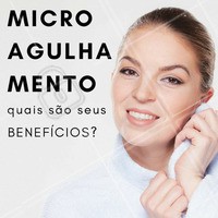 O microagulhamento é usado como tratamento contra o envelhecimento, a flacidez, cicatrizes de acne ou queimaduras e manchas na pele. Se você quer uma pele de pêssego bem lisinha, não perca mais tempo e agende já o seu horário! #microagulhamento #estéticafacial #colágeno #peleperfeita #amo #ahazou #tratamentofacial #benefícios