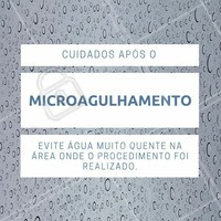 Cuidado! Nas 24 horas seguintes do seu microagulhamento, tome cuidado com o uso de água muito quente para lavar o rosto ou no banho, pois sua pele estará muito sensível. #microagulhamento #cuidados #águaquente #estéticafacial #colágeno #peleperfeita #amo #ahazou #tratamentofacial