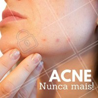 Ela aparece da noite para o dia, normalmente, não tem hora para ir embora. A acne acontece quando há obstrução do canal do folículo, mas aqui temos o tratamento certo para acabar com ela. Venha fazer uma avaliação! #esteticafacial #acne #espinha #ahazou #beleza #tratamentofacial #autoestima