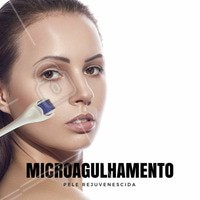 ➡ O Microagulhamento é indicado para:
✅ Aumento da penetração e ação de substâncias ativas;
✅ Melhoria da textura da pele;
✅ Espessamento da epiderme;
✅ Rejuvenescimento da pele;
✅ Pele danificada pelo sol;
✅ Hipo ou hiperpigmentação;
✅ Grandes poros, produção sebácea excessiva;
✅ Rugas (leves, médias e profundas);
✅ Estrias;
✅ Cicatrizes, inclusive de acne e de queimaduras;
✅ Alopécia
➡ Contra-indicações
O uso do microagulhamento é contra-indicado para pessoas com tendência a quelóides, dificuldades de cicatrização, com acne e piodermites.
➡ Resultados
A indução da produção de colágeno e elastina proporcionada pelo microagulhamento, é observada após a primeira sessão de tratamento. O paciente percebe significativa melhora das rugas, cicatrizes, melanoses e problemas de pigmentação, tendo sua pele com aspecto notadamente rejuvenescido.
#microagulhamento #colágeno #tratamentofacial #beleza #estetica #ahazou #autoestima #rejuvenescimentofacial #rugas #estrias