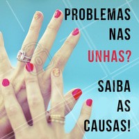 As unhas podem indicar muitos sinais sobre nossa saúde! Se o seu problema é com ondulações: isso pode acontecer se você cutuca excessivamente a cutícula. Se você tem muitos pontos brancos: indicam microtraumas pontuais e em casos mais raros, falta de vitaminas. Se a unha quebra sempre, pode ser uma condição biológica que faz algumas pessoas terem unhas mais finas ou falta de vitaminas. A unha amarelada pode estar manchada por esmalte ou ingestão de medicamentos que alteram a cor delas! 💅 Cuide bem das suas unhas, agende seu horário! ☎️ #unhas #manicure #ahazou #cuidadocomasunhas