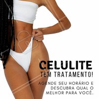 Você achava que celulite não tinha tratamento? Hoje em dia existem diversas opções para amenizar a celulite. Para saber qual o seu tipo e qual o melhor jeito de tratar, agende seu horário ☎️ #Celulite #ahazou #EsteticaCorporal