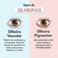 Dica de hoje! Temos tratamento exclusivos para as suas olheiras, venha fazer uma avaliação! #olheiravasculhar #olheirapigmentar #esteticafacial #tratamentofacial #ahazou #beleza #olheira #autoestima