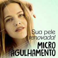 Renove a qualidade da sua pele e aproveite os benefícios do microagulhamento! 💆 #microagulhamento #pele #ahazou #esteticafacial