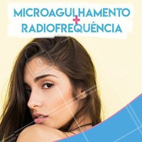 O microagulhamento atenua poros dilatados, clareia manchas como o melasma, melhora a textura geral da pele, suaviza cicatrizes de acne e rugas. Já a radiofrequência fracionada atua no combate à flacidez cutânea, estimulando a produção de colágeno novo, recuperando a firmeza perdida com o passar dos anos e redefinindo o contorno facial! Aproveite esse combo maravilhoso e renove sua pele 💆 #microagulhamento #ahazou #esteticafacial #estetica #radiofrequencia #cuidadoscomapele