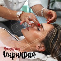 A acupuntura tem inúmeros benefícios para o corpo, como: ajuda no emagrecimento, melhora a dor nas costas, reduz o estresse, alivia problemas estomacais, alívio para dores de cabeça, diminui a ansiedade e sintomas de depressão, sintomas da TPM e outros diversos tipos de dores! O tratamento da acupuntura é personalizado de acordo com cada pessoa, por isso consulte sempre um profissional. #acupuntura #ahazou #saude #bemestar