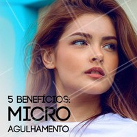 1 - Redução de cicatrizes
2 - Estimula a produção de colágeno
3 - Facilita a absorção de produtos na pele
4 - Combate as rugas
5 - Diminui as manchas na epiderme
#microagulhamento #ahazou #esteticafacial #ahazoufacial #cuidadoscomapele
