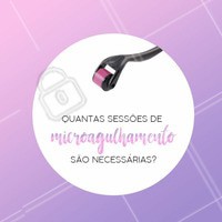 Em geral são feitas entre três e quatro sessões de microagulhamento, com intervalo de um mês entre elas, para recuperação da pele. Mas a quantidade de sessões e intervalo podem variar de acordo com a finalidade do tratamento e as características da agulha usada. Cada sessão dura, em média, de 30 minutos a uma hora.
#microagulhamento #peleperfeita #estéticafacial #ahazou #ahazouestetica