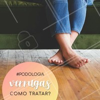 Às vezes, as verrugas desaparecem por conta própria. No entanto, muitas verrugas podem se tornar cada vez maiores e mais dolorosas, além de começarem a multiplicar-se em aglomerados.
O tratamento mais comum é o uso do ácido salicílico, que quando aplicado diariamente, suaviza gradualmente as camadas da pele de modo que a verruga possa ser removida.
Por isso é muito importante procurar um profissional para saber qual o tratamento mais indicado para você!
#verrugas #ahazou #podologia #tratamento