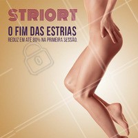 Você já conhece essa técnica ortomolecular? O STRIORT é capaz de reduzir 80% da aparência das tão temidas estrias brancas já na primeira sessão! E o melhor: esse método é não invasivo e não cirúrgico. #esteticacorporal #striort #ortomolecular #estrias #ahazou #tecnicastriot #estetica #adeusestrias