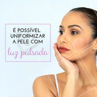 A luz pulsada emite luz com diferentes comprimentos de ondas, atingindo, vários tipos de alvos como a melanina, os vasos sanguíneos e o colágeno. Ela pode recuperar a cor uniforme do rosto e melhorar a elasticidade da pele.
#luzpulsada #pele #ahazouestetica #esteticafacial