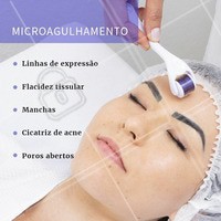 O microagulhamento tem muitos benefícios! Conheça o poder transformador das agulhas e mude a aparência da sua pele. #esteticafacial #ahazou #microagulhamento
