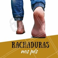 As rachaduras dos pés podem ser causadas pelo atrito dos sapatos ou falta de hidratação. Isso causa o engrossamento (acúmulo de queratose) da epiderme dos pés. Depois do engrossamento, vem os calos que podem ser acompanhados de fissuras (rachaduras). #rachadura #ahazou #pés #podologia #fissuras #calos #peressecado