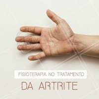 Você sabia que a Fisioterapia é capaz de diminuir a dor, prevenir e diminuir as deformidades da articulação, além de garantir a capacidade de realizar atividades cotidianas de forma independente? #fisioterapia #ahazou #artrite