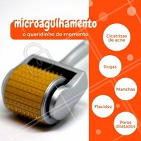 O microagulhamento tem sido eleito o tratamento queridinho das famosas, e não é por acaso! O tratamento é capaz de tratar diversos problemas do rosto. Agende sua avaliação e inicie o tratamento! #microagulhamento #ahazou #esteticafacial